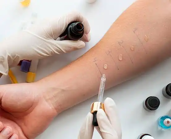 Food Allergy Treatment